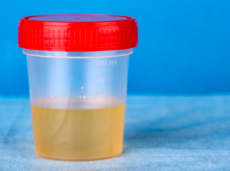 what-does-cloudy-urine-mean